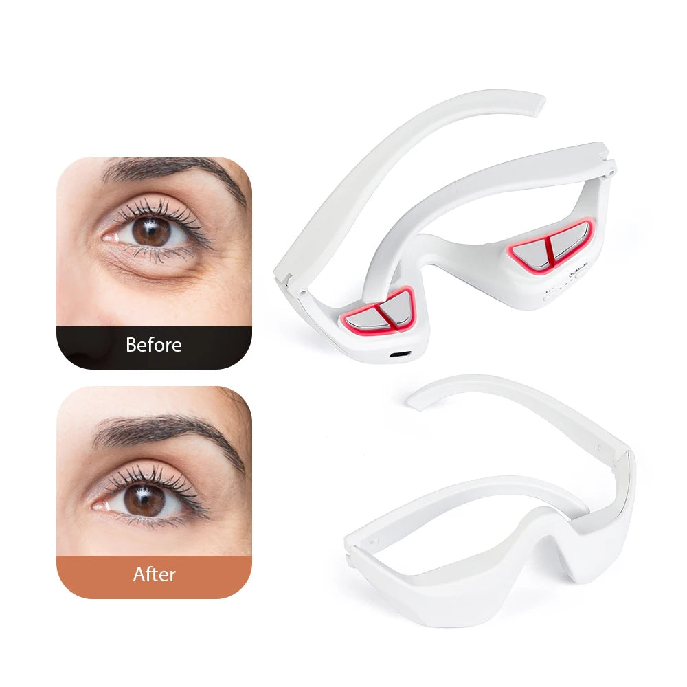 Revitalizer Eye Massager and Dark Circle Smoother